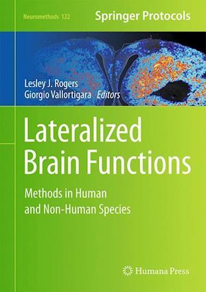 Lateralized Brain Functions