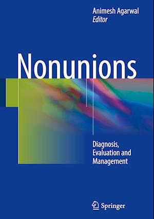 Nonunions