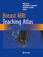 Breast MRI Teaching Atlas