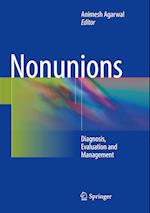 Nonunions