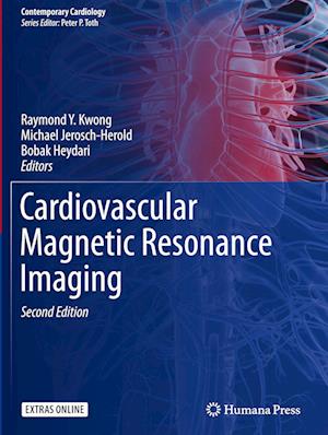 Cardiovascular Magnetic Resonance Imaging