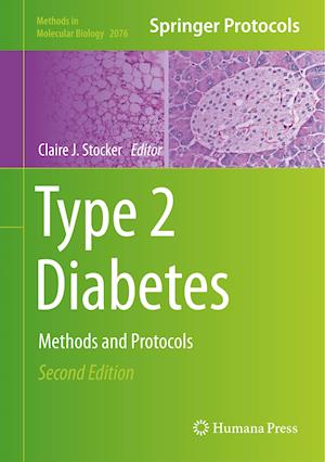 Type 2 Diabetes