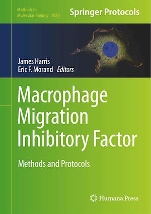 Macrophage Migration Inhibitory Factor