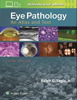 Eye Pathology