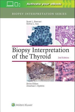 Biopsy Interpretation of the Thyroid