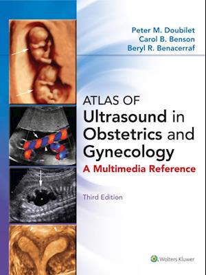 Atlas of Ultrasound in Obstetrics and Gynecology