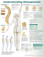 Understanding Osteoporosis