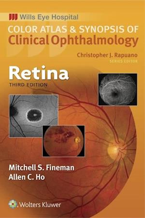 Retina