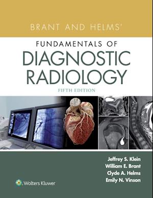 Brant and Helms' Fundamentals of Diagnostic Radiology