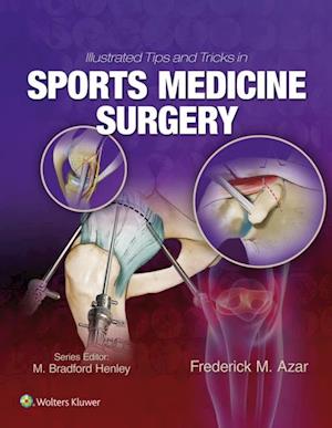 Illustrated Tips and Tricks in Sports Medicine Surgery