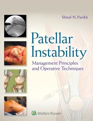 Patellar Instability