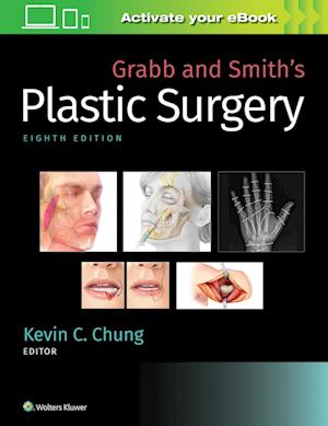 Grabb and Smith's Plastic Surgery