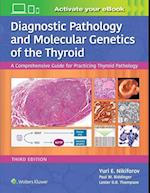 Diagnostic Pathology and Molecular Genetics of the Thyroid