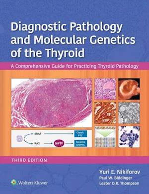 Diagnostic Pathology and Molecular Genetics of the Thyroid