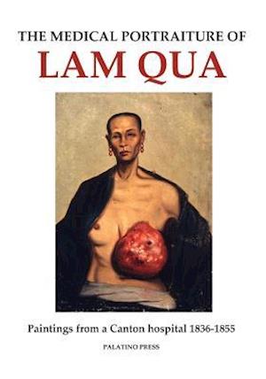 The Medical Portraiture of Lam Qua