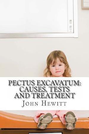 Pectus Excavatum