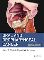 Oral and Oropharyngeal Cancer
