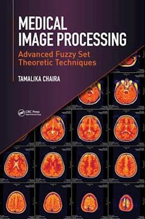 Medical Image Processing