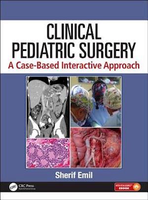 Clinical Pediatric Surgery
