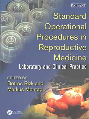 Standard Operational Procedures in Reproductive Medicine