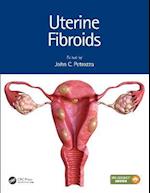 Uterine Fibroids