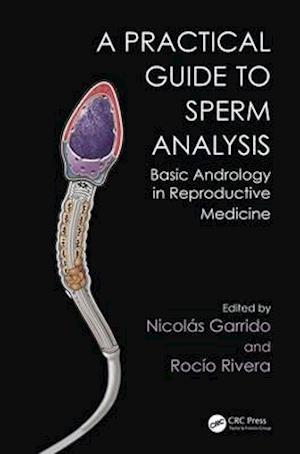 Practical Guide to Sperm Analysis