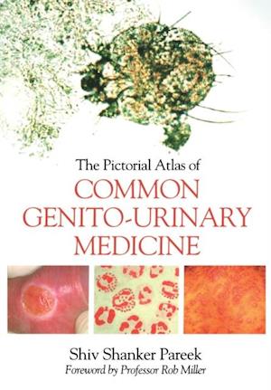 Pictorial Atlas of Common Genito-Urinary Medicine