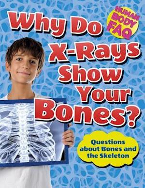 Why Do X-Rays Show Your Bones?