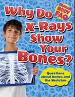 Why Do X-Rays Show Your Bones?