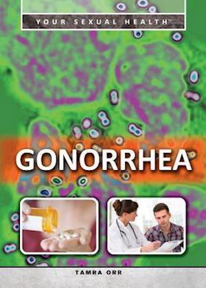 Gonorrhea