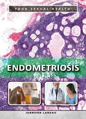 Endometriosis