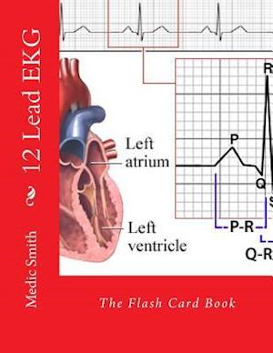 12 Lead EKG