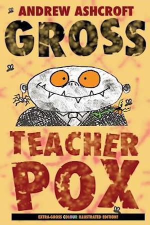 Gross Teacherpox