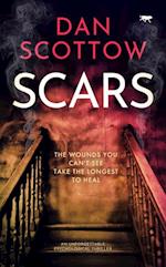 Scars