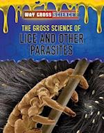 The Gross Science of Lice and Other Parasites