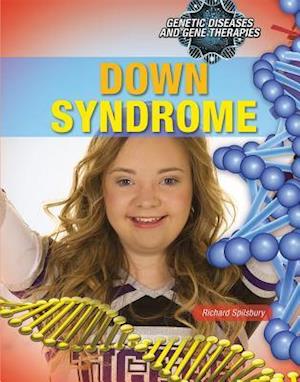 Down Syndrome