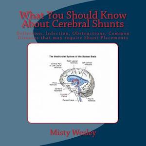 What You Should Know about Cerebral Shunts