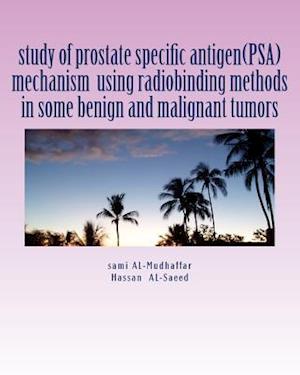 study of prostate specific antigen(PSA) mechanism using radiobinding methods in some benign and malignant tumors