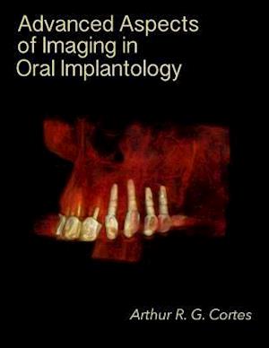 Advanced Aspects of Imaging in Oral Implantology