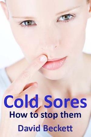 Cold Sores