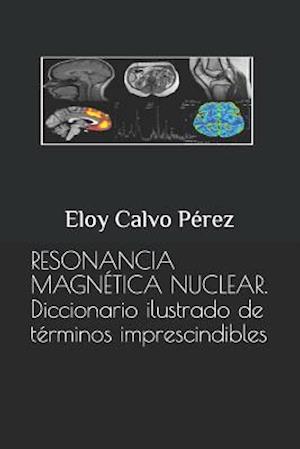 Resonancia Magnética Nuclear