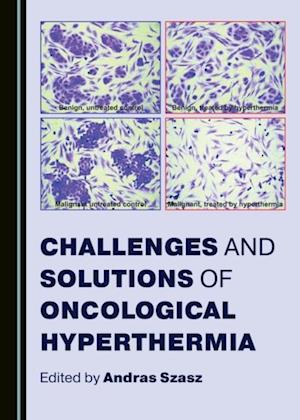 Challenges and Solutions of Oncological Hyperthermia
