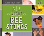 All about Bee Stings