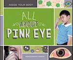All about Pink Eye