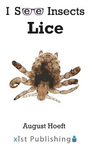 Lice