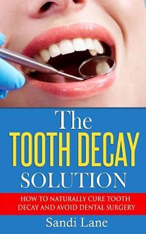 The Tooth Decay Solution