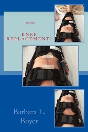 Read This BEFORE Your Knee Replacement