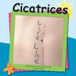 Cicatrices