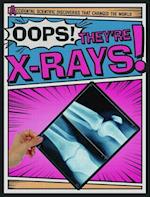 Oops! They're X-Rays!