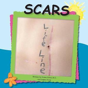 Scars